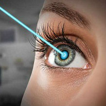 Что такое рефракционная хирургия глаз