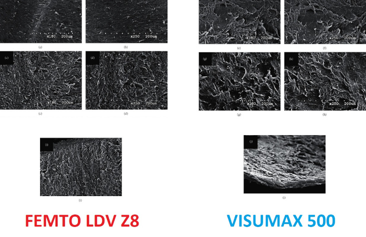 Изображения поверхностей и краев лентикулы при сканирующей электронной микроскопии, созданных с помощью Femto LDV Z8 и VisuMax 500 при увеличении ×180 и ×250.